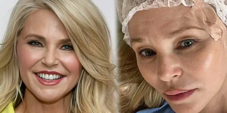 Who is Christie Brinkley? Peter Cook’s Ex-Wife Diagnosed With Skin Cancer